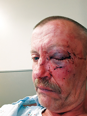 Danny Mayberry says this was from an altercation with a sheriff’s deputy.