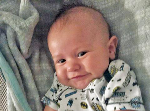 Local baby Maddox Nelson is all smiles despite having a rare birth defect called hypospadias.