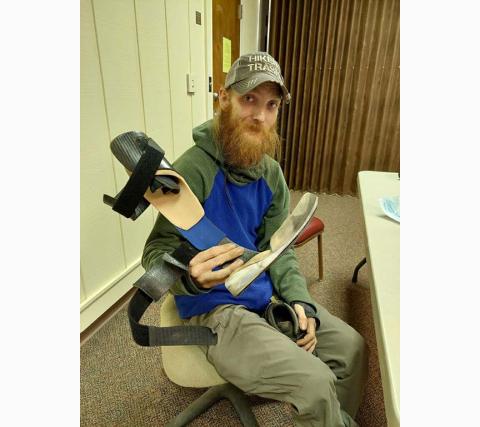 Photos contributed by Chris Phillips  Chris holding his prosthetic foot.